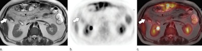 2016 02 18 16 53 40 980 2016 02 19 Pet Mri Crohns 800