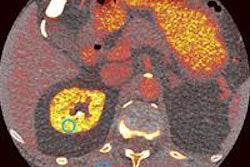 2016 02 24 16 04 50 183 20160224 Photon Counting 20160224230514