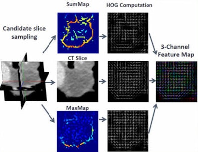 Enhanced three-channel feature map. Contained within the enhanced map is higher-level semantic information derived from the preprocessed lymph-node-selective visual responses. These features are then used to train an SVM for binary classification of 2D views as either containing a lymph node or not. The SVM scores for views sampled from the same volume of interest are averaged to obtain the final candidate-level predictions.
