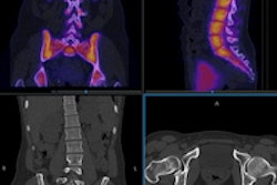 2016 02 26 14 59 01 854 Box Clinical Images 200