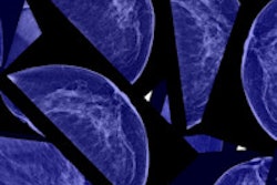 2016 01 19 17 54 08 401 Breast Mammo 200