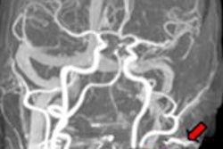 2016 02 26 17 35 00 304 2016 03 02 Ecr Today Artifact 20160227003620