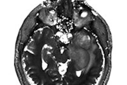 2016 03 02 18 01 27 429 2016 03 03 Ecr Today Mr Fingerprinting Thumb