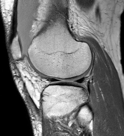 Musculoskeletal imaging is an area of special expertise among Colombian radiologists.