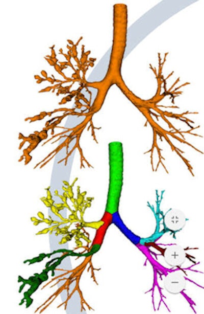Airway segmentation with vessels assigned to each lobe. Image courtesy of Oliver Weinheimer, PhD.