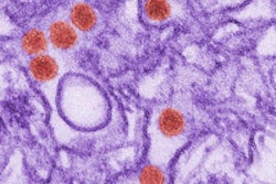 2016 03 15 10 26 19 553 Zika Virus 200