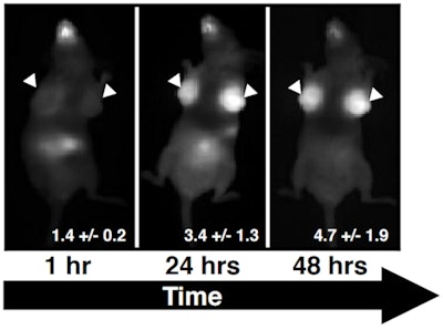 A scan of one of the mice with orthotopic breast cancer tumors. Image courtesy of Dr. Greg Thurber, PhD.