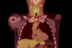 2016 03 23 14 36 10 910 2016 03 24 Pet Ct Mehanna Image 20160323213859