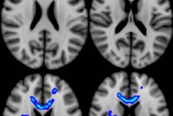 2016 03 29 09 36 47 469 Dti Mild Tbi Rad Ware 200