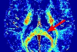 2016 03 30 16 56 34 129 Myelin Rauscher Plos One 200
