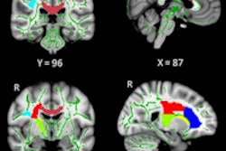 2016 04 05 11 07 52 736 2016 04 05 Rad Jiang Dti 200