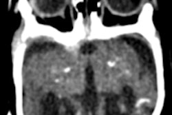 2016 04 08 14 32 38 413 Zika Nejm 200