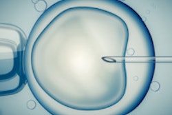 2016 04 13 09 35 12 451 Ivf Infertility 200