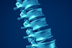 2016 04 14 12 01 15 173 Spine 200