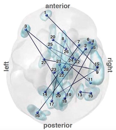 A map of brain connections that proved useful in distinguishing people diagnosed with autism from those without an autism diagnosis. Image courtesy of Brown University.
