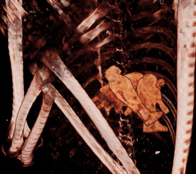 A 3D CT image showing the four sons of Horus within the chest of Ramses III. The head of each statue is well depicted in the 3D reconstruction: a human, baboon, jackal, and falcon.