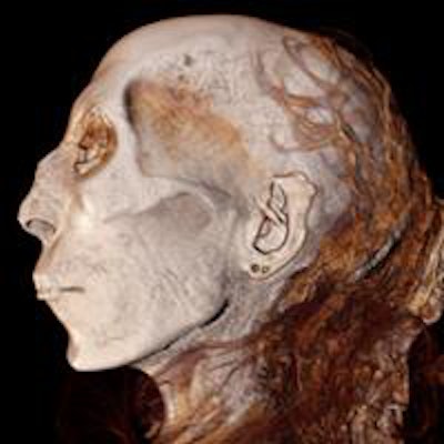 2016 04 26 11 10 02 100 2016 04 27 Mummy 3 D Ct Profile Face Of Thuya Great Grandmother Of Tutankhamun 20160426182227