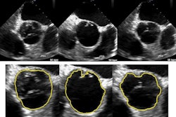 2016 04 28 09 52 25 21 Wavelet Ultrasound 450