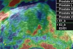 2016 04 28 15 56 46 231 Elastography Lee 500 20160428230216