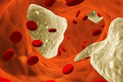 2015 11 09 15 32 42 48 Atherosclerosis Clot 200