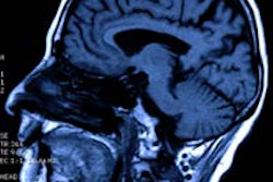 2015 11 12 10 29 21 842 Brain Mri 200