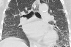 2016 04 28 12 00 53 883 2016 05 02 Mers Figure 3 20160428190114