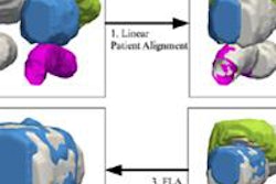 2016 04 29 14 21 17 510 2016 05 Madabhushi Prostate Algorithm 20160429212903