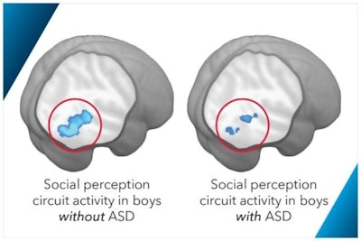 Functional MRI illustrates brain regions affected by autism spectrum disorder. Image courtesy of George Washington University.