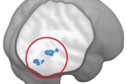 2016 05 05 16 54 14 769 F Mri Autism Images 200