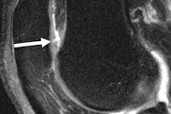 2016 05 11 11 25 48 131 Mri Insider Image 03 200