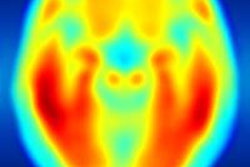 2016 05 11 15 35 52 467 T807 Image 400 20160511223615