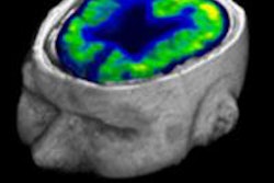 2016 05 26 11 01 08 608 2016 05 27 Fdg Pet Brain Scans 20160526183028