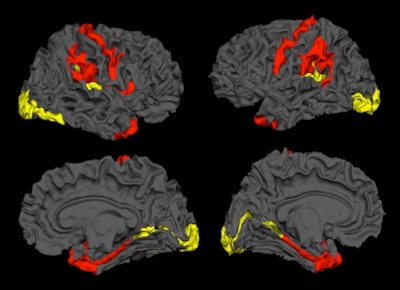 Image credit: Dr. Lena Palaniyappan, PhD.