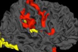2016 05 27 15 38 28 160 Schizophrenia 450 20160531155944