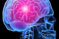 2014 03 17 14 58 37 756 Brain Headache 200