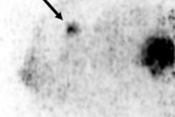 2016 06 01 16 34 56 821 Mammi Pet Breast 200