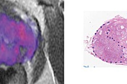 2016 06 02 10 10 57 157 Rsi Mri Image Crc