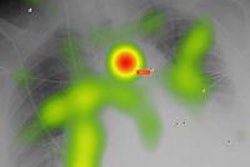 2016 06 07 15 54 27 136 2016 06 08 Eyegaze Lung Wolfe Bottom 20160607230109