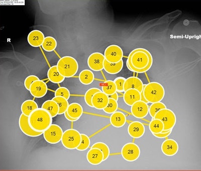 Above, eye-tracking scan path; below, heat map representing where observers looked. Images courtesy of Elizabeth Krupinski, PhD, Emory University.