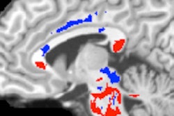 2016 06 09 11 54 49 652 Dti Mri Lipton Ajn 200