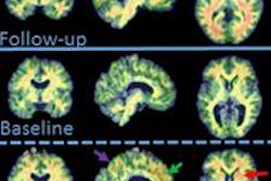 2016 06 12 19 32 34 35 Pet Down Syndrome Lao Snmmi 450 20160613023313