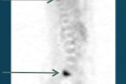 2016 06 15 10 08 34 107 Peterson Snmmi Fdg 200