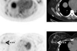 2016 06 21 14 49 54 755 Fluciclovine 200