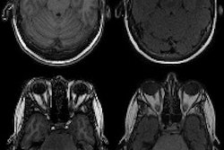 2016 06 24 17 25 10 53 Incidental Brain Mri Bos 200