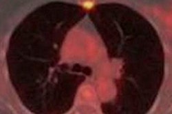 2016 06 28 16 12 48 745 Castillo Petct 200