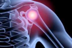 2015 04 23 14 16 54 797 Shoulder 200