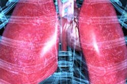 2015 05 14 16 38 39 389 Lung 200