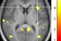 2016 07 12 14 20 25 332 Mri Water Image 01 450 20160712212904