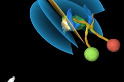 2016 07 29 11 21 54 417 2016 07 29 Brainlab 400