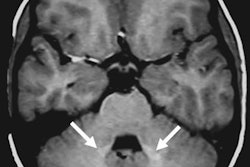 2016 08 02 16 34 58 73 Gbca Images Radiology Flood 20160802233629